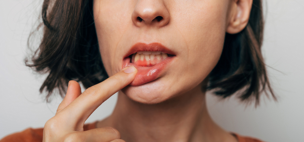 歯周病の自分での治し方はある？予防する方法や正しい歯磨き方法を紹介