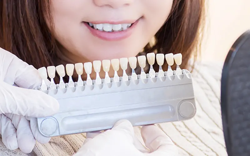 歯の清掃と色調確認